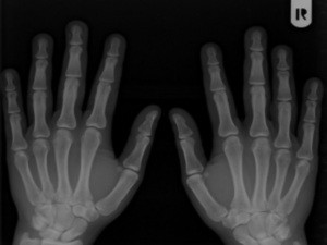 xray-reka.jpg